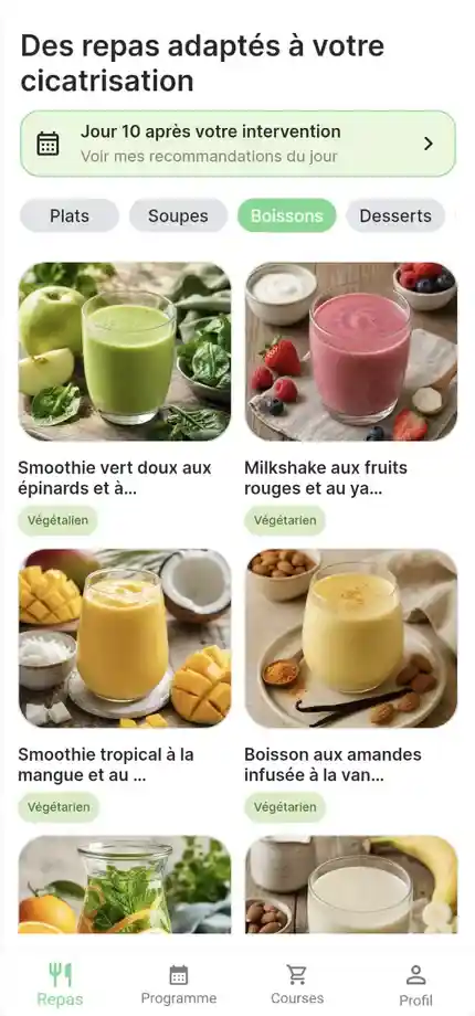 Sélection de boissons PostSurgNutrition